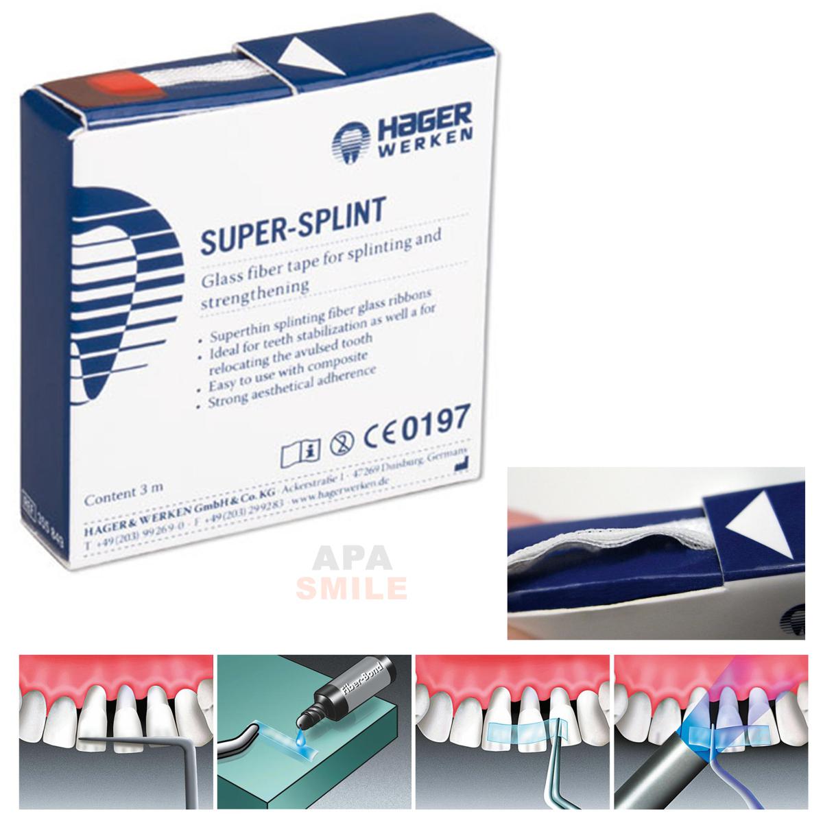 نوار اسپلینت - Super-Splint